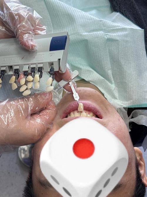 保定市二医院植牙效果如何？价格贵不贵？技术靠谱吗？-图2