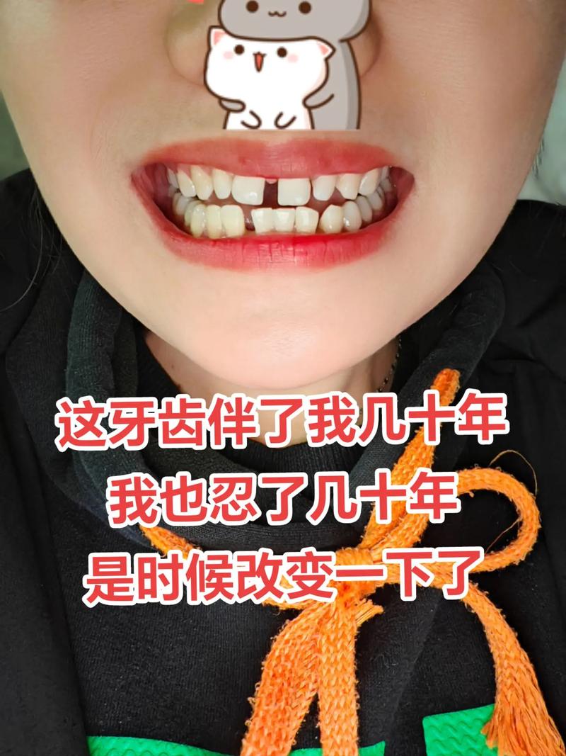 带全植牙会口臭吗-图3