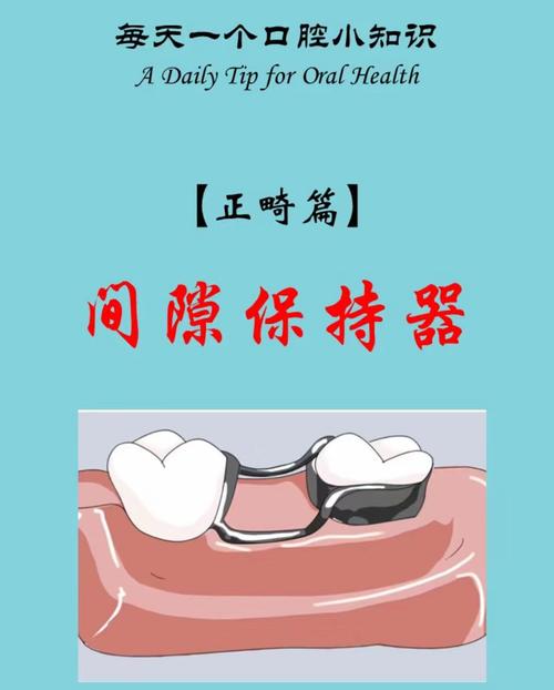 滑动法关闭正畸间隙-图3