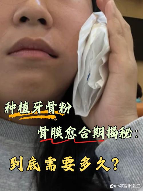 种牙植骨粉出来了-图1