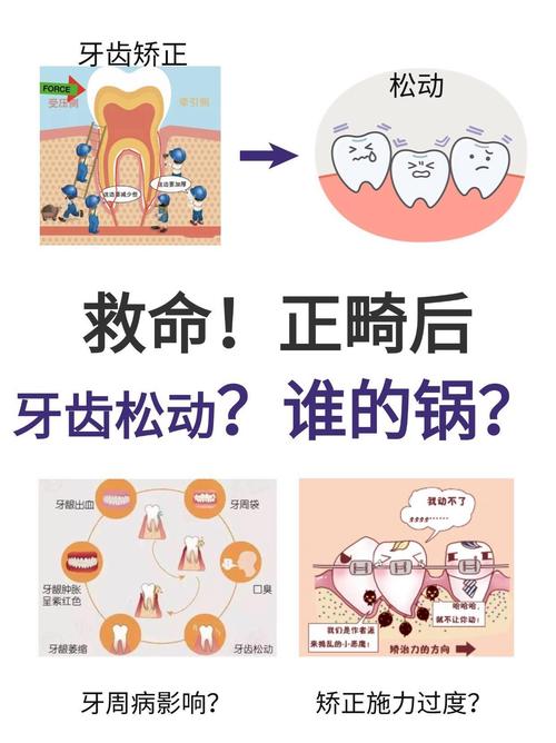 属于正畸治疗引起的-图1