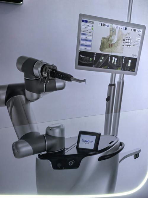 全数字话导航植牙-图1