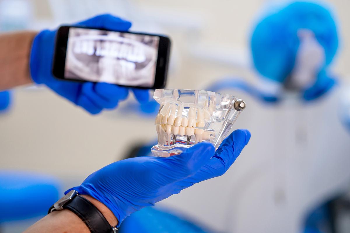 全数字话导航植牙-图3