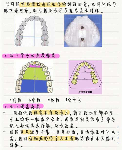 正畸模型测量的内容-图2