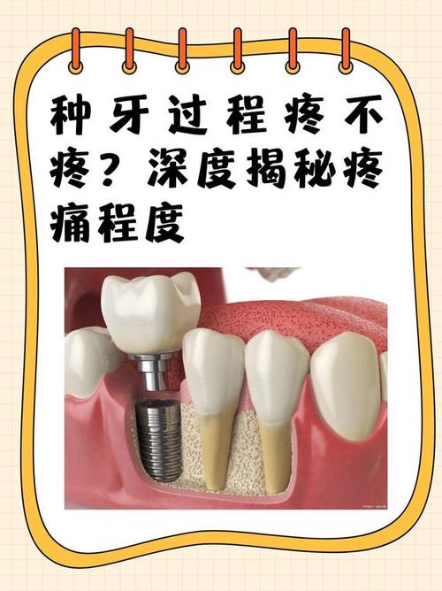 镶牙与植牙，哪个更疼？治疗过程和术后疼痛全对比？-图2