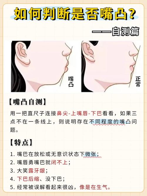 正畸矫正凸嘴，究竟能改善几毫米？-图2