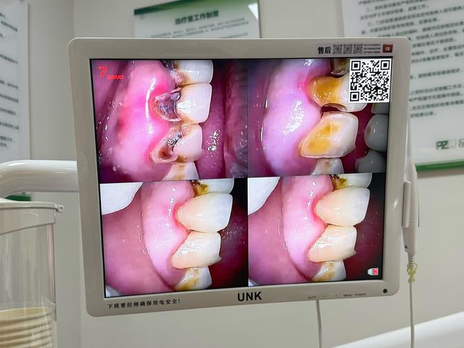 私人诊所拔牙植牙-图3