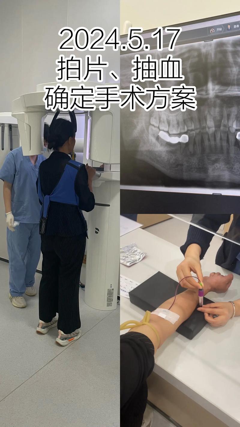 兰州植牙机构怎么选？哪家的技术和口碑最好？-图2