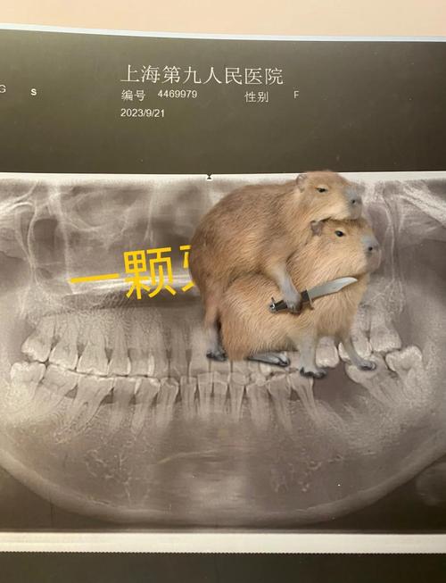 九院植牙系统效果如何?技术有何优势?适合哪些情况?靠谱吗?-图1 九院植牙系统效果如何?技术有何优势?适合哪些情况?靠谱吗?-图1