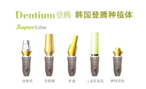韩国植牙品牌好吗-图2 韩国植牙品牌好吗-图2