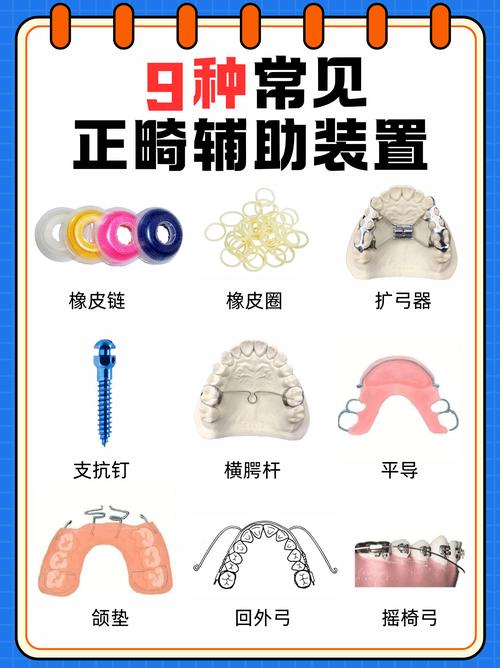 正畸的工具都有那些-图2