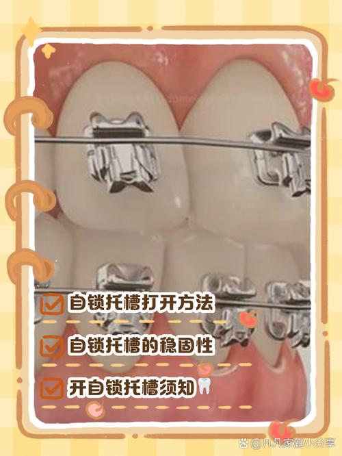 正畸托槽受力方向如何影响牙齿矫正效果？-图2