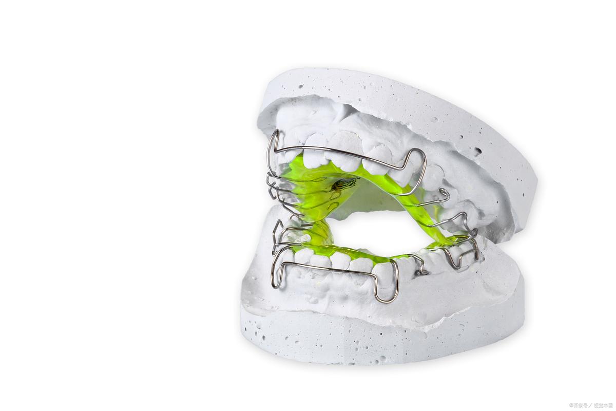 牙科正畸使用的器械-图1