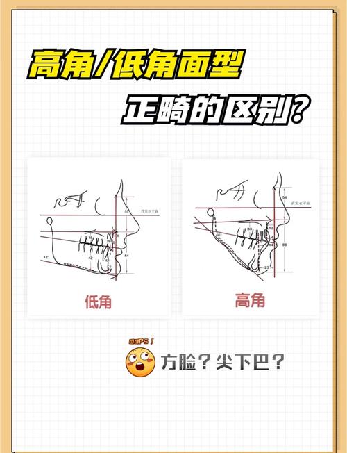正畸SN MP角度-图2 正畸SN MP角度-图2