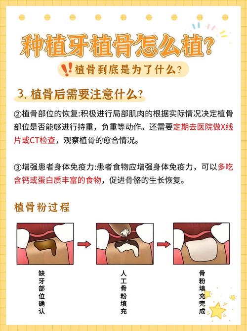 种牙植骨注意事项-图1
