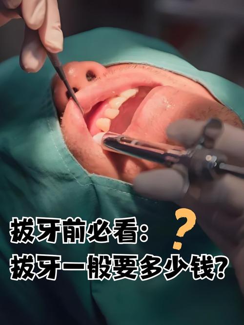 正畸前 拔牙 多久-图2