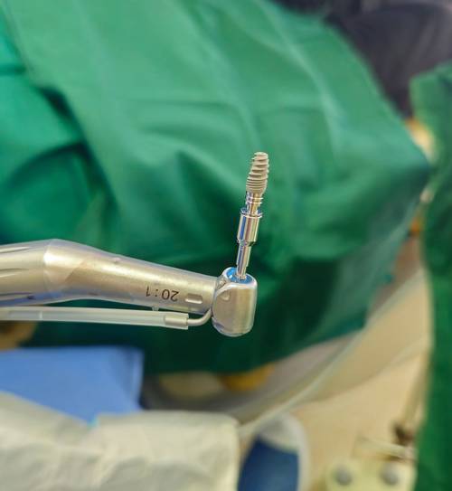 种植牙植体的器械-图1