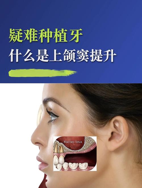 种植牙植骨成功率受哪些关键因素影响？-图3