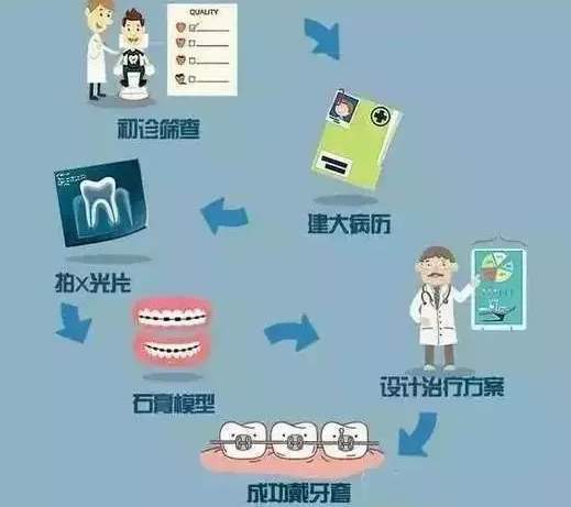正畸初诊流程包含哪些关键步骤?初诊时要注意什么?-图2 正畸初诊流程包含哪些关键步骤?初诊时要注意什么?-图2