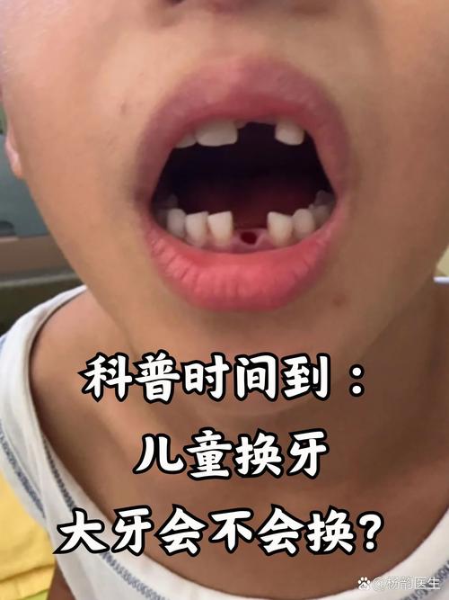小孩子能植牙吗-图1 小孩子能植牙吗-图1