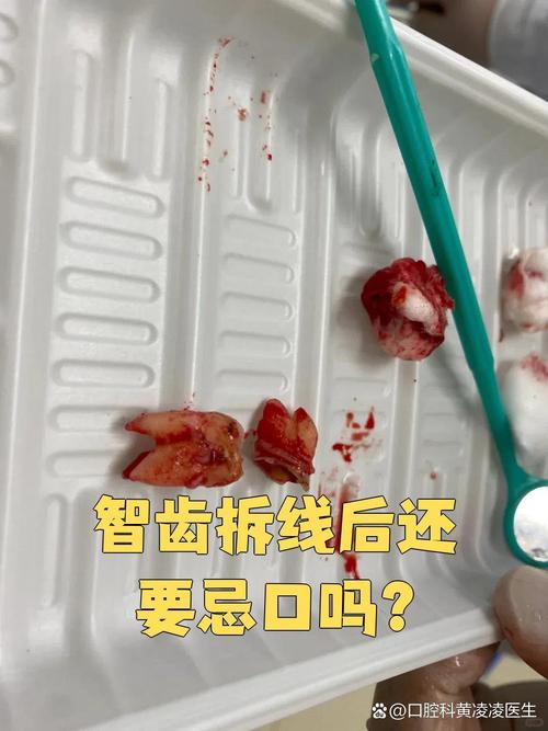 植完牙拆线痛吗-图3