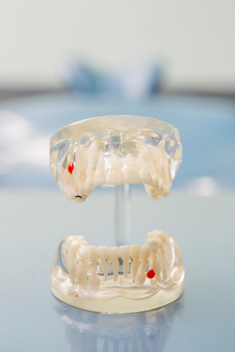 正畸托槽demon-图2