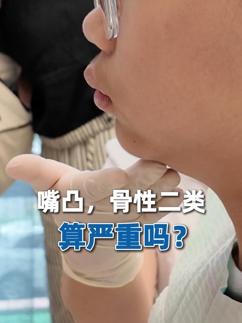 骨性二类错颌患者能通过正畸治疗改善吗？-图3