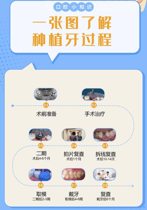 植牙系统哪种好？如何挑选适合自己的优质品牌？-图2