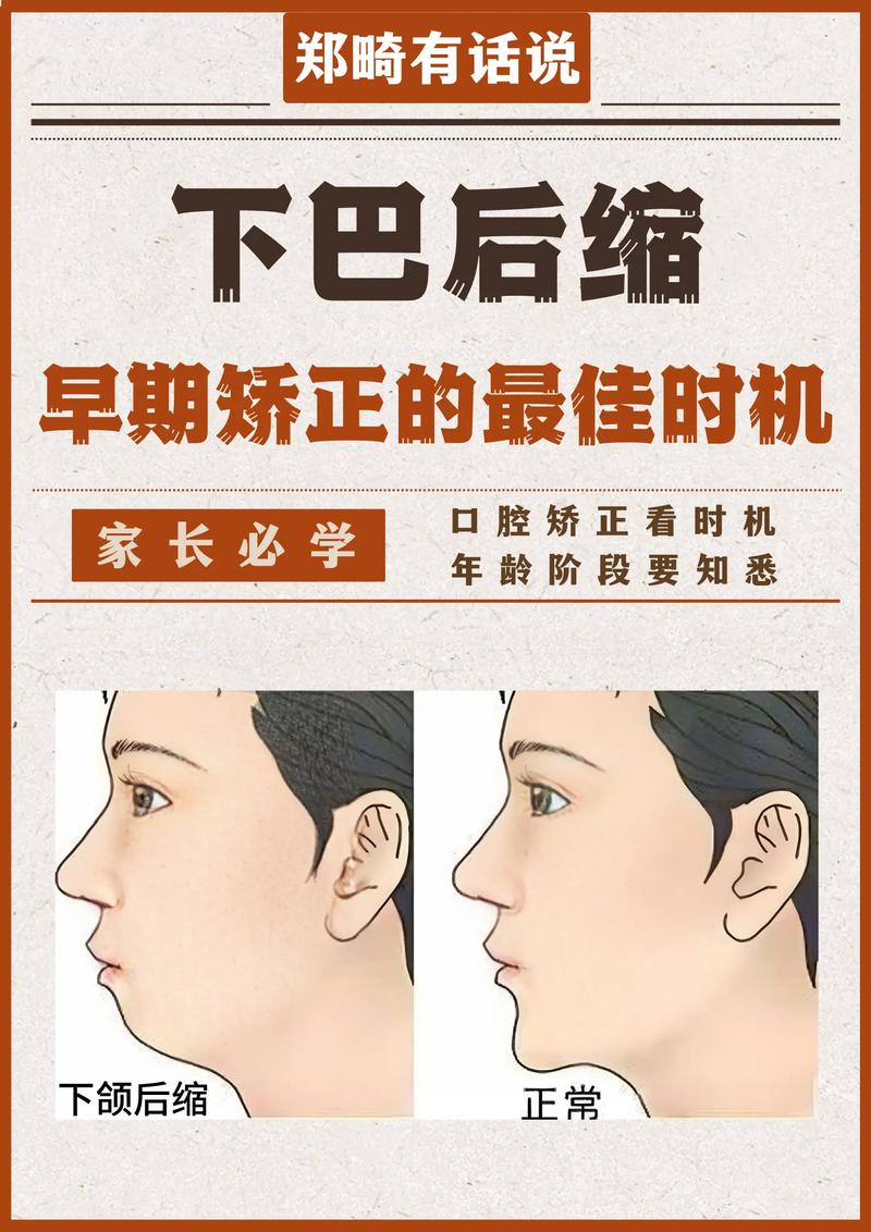 正畸后下巴会显出来吗？效果因人而异？-图2
