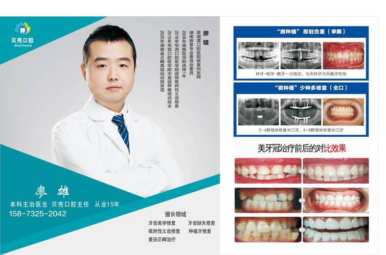 湖南植牙哪里好-图2