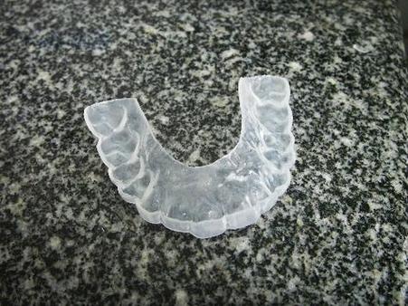 正畸中牙合垫的作用-图2