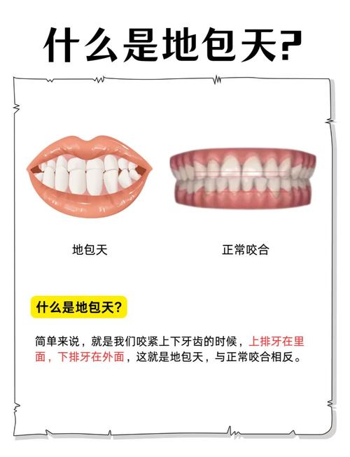 齐齿地包天正畸的矫正原理具体是什么？-图1