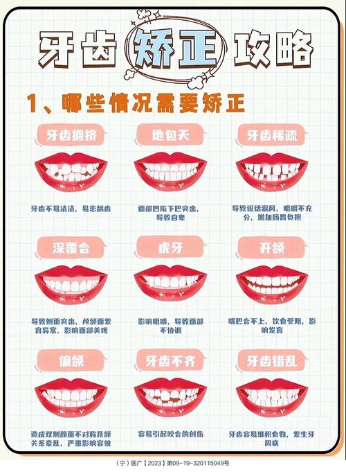 齐齿地包天正畸的矫正原理具体是什么？-图2