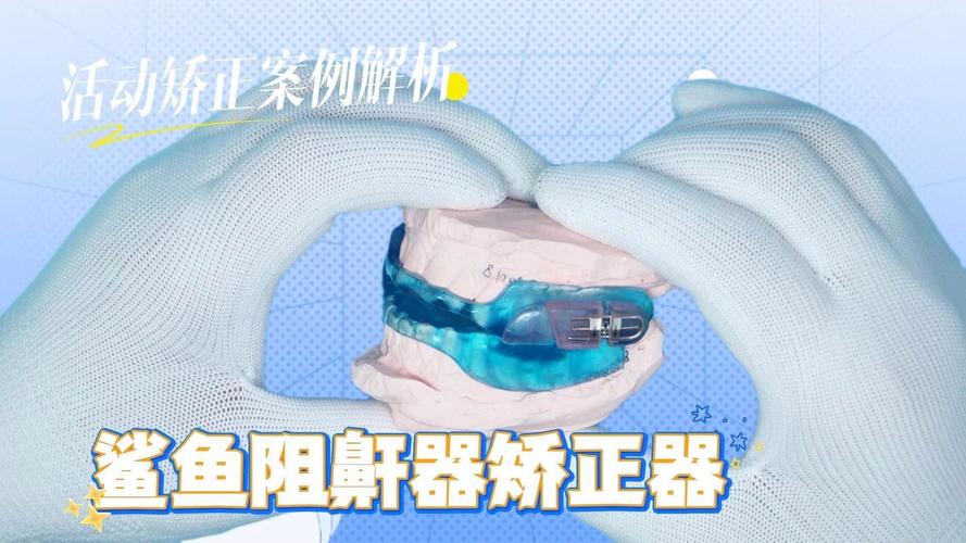 妃她正畸活动矫正器-图1