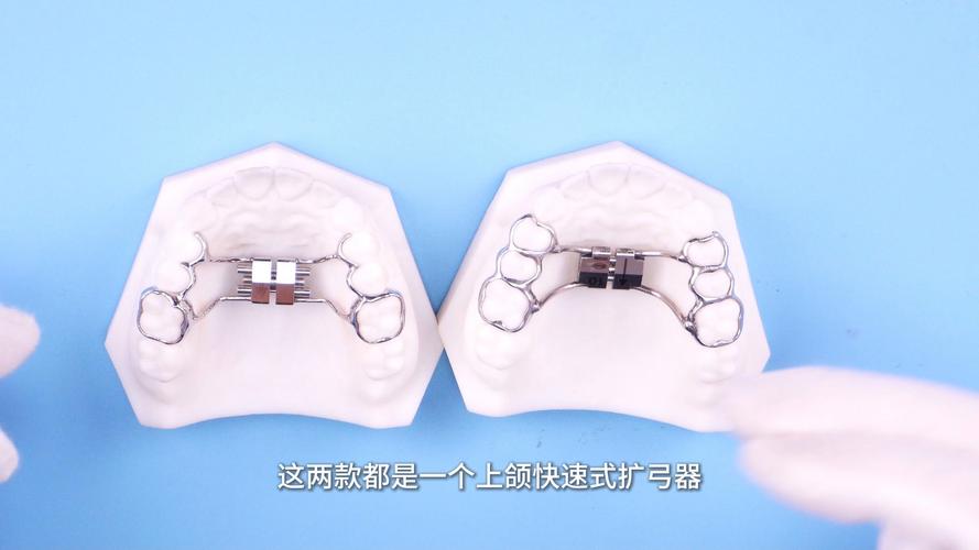 妃她正畸活动矫正器-图3