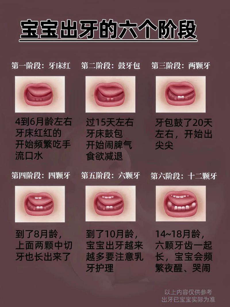 上牙植牙需要几个月恢复？-图1