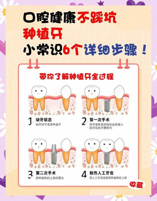 上牙植牙需要几个月恢复？-图2