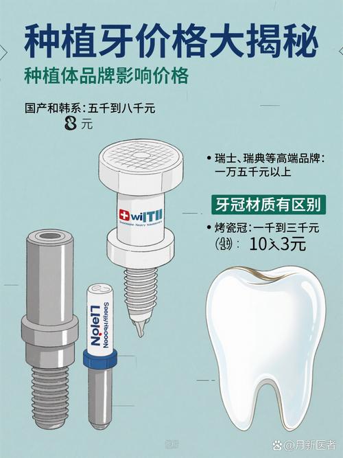 牙博士植牙贵不贵？具体收费多少？性价比怎么样？-图1