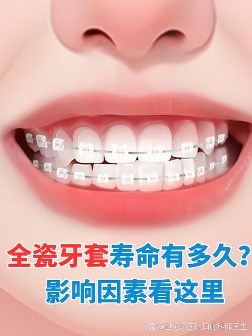 全瓷牙可以做正畸吗？-图2