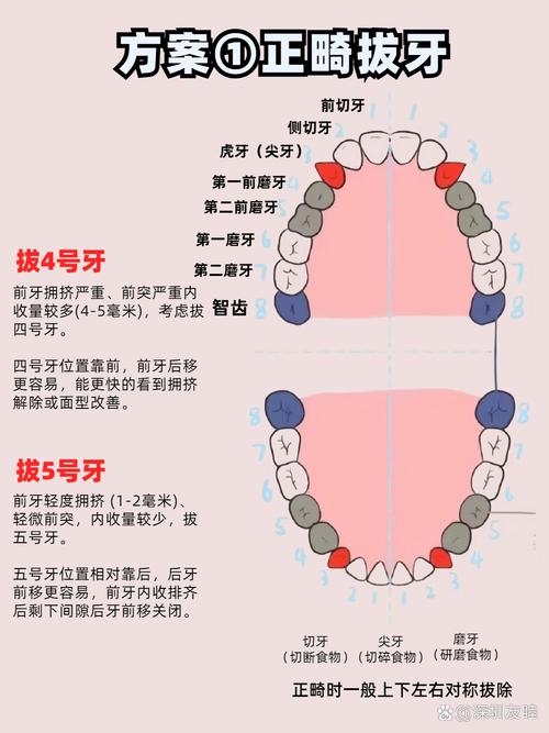 正畸拔牙收牙缝时间-图2 正畸拔牙收牙缝时间-图2