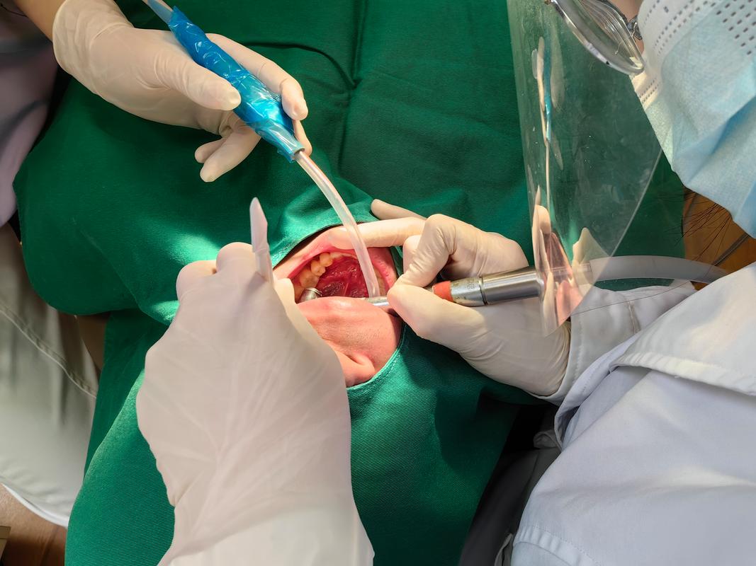 根管治疗 牙齿正畸-图1