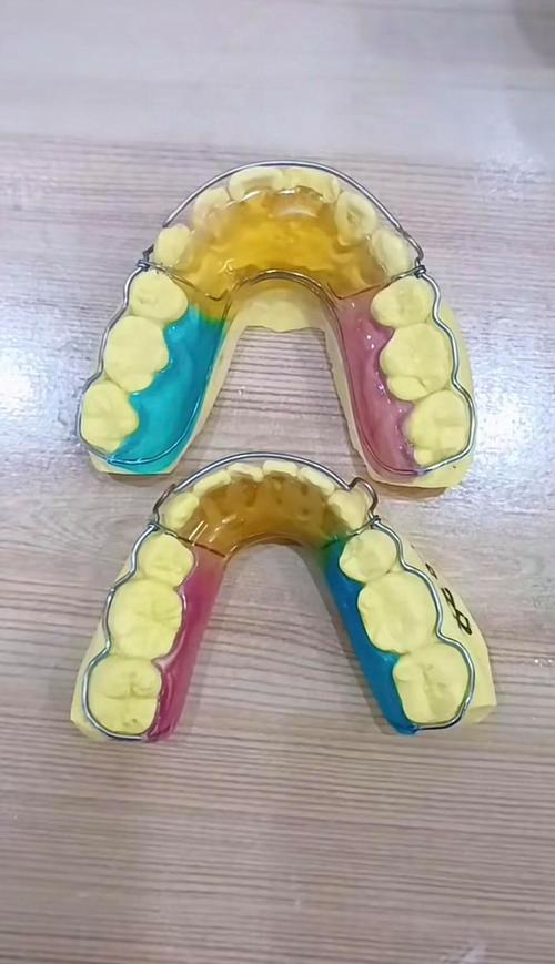 保持器 正畸 图片-图1