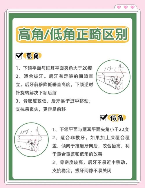 正畸高角低角的定义-图2