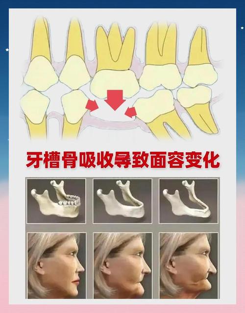 正畸智齿一定要拔吗-图2