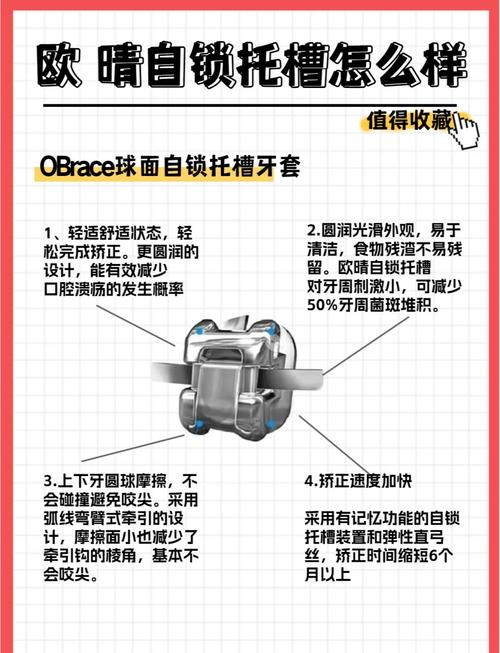 自锁牙套 正畸原理-图1