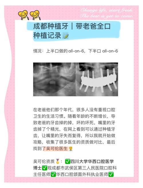 成都 植牙-图2