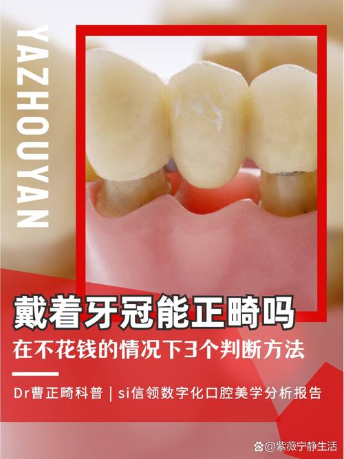 有烤瓷牙能做正畸矫正吗？-图1