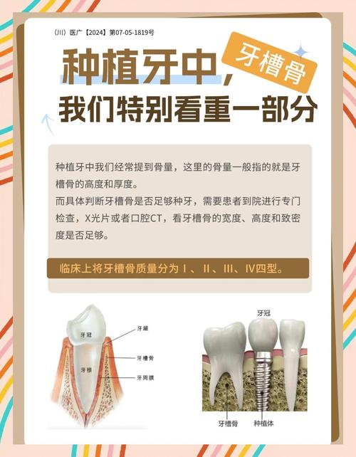 牙槽骨不足必须植骨吗?手术效果如何?-图2 牙槽骨不足必须植骨吗?手术效果如何?-图2