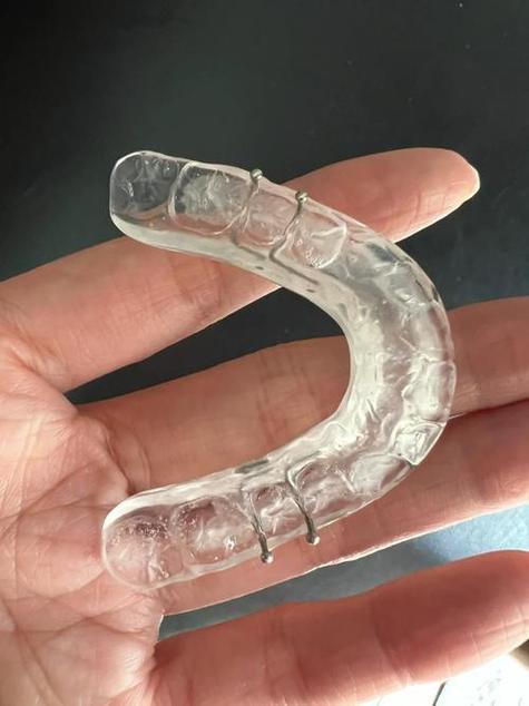 正畸颌垫是干嘛用的-图1