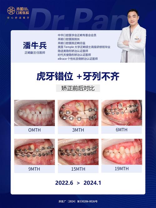 牙科正畸科看些什么-图2 牙科正畸科看些什么-图2